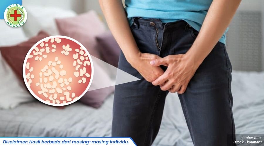 keluar cairan putih di penis 1_2_11zon