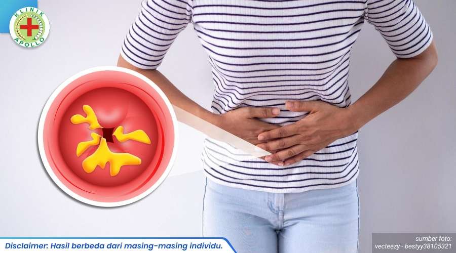 mengobati keputihan berwarna kuning 2_6_11zon