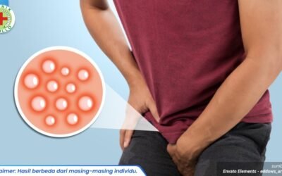 bintik merah di penis 1_1_11zon