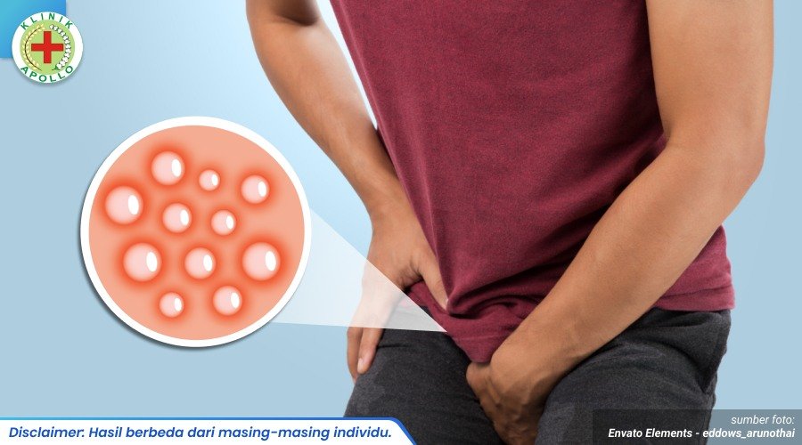 bintik merah di penis 1_1_11zon