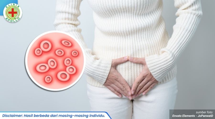 bintik merah menyebar di kelamin 1_1_11zon