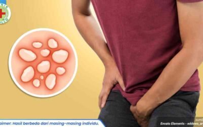 gejala herpes kulit kelamin 1_3_11zon