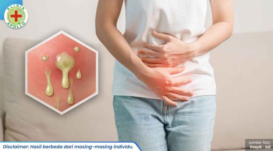 gejala kencing nanah pada wanita_1_1_11zon