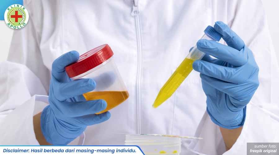 Urine Keruh 1_6_11zon