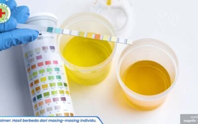 tes urine 1