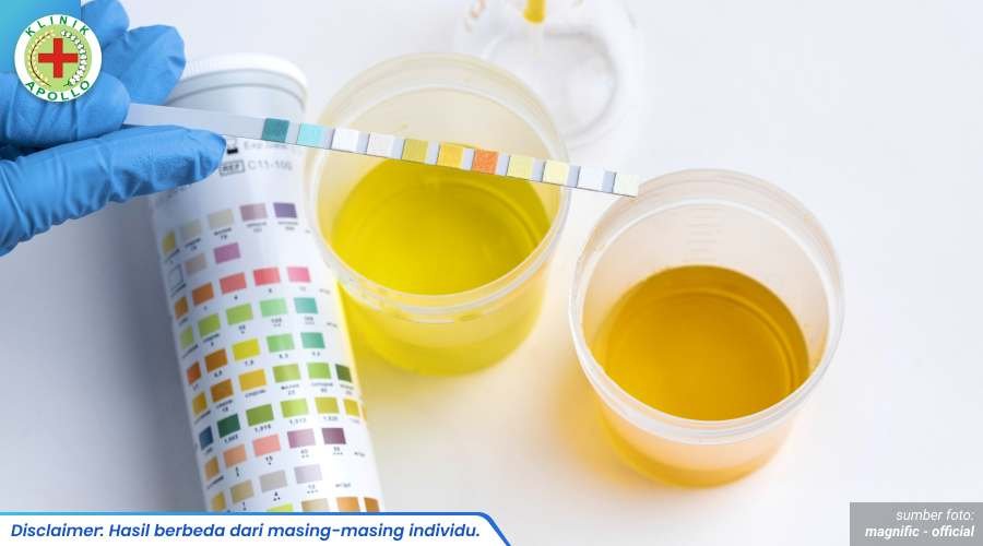 tes urine 1